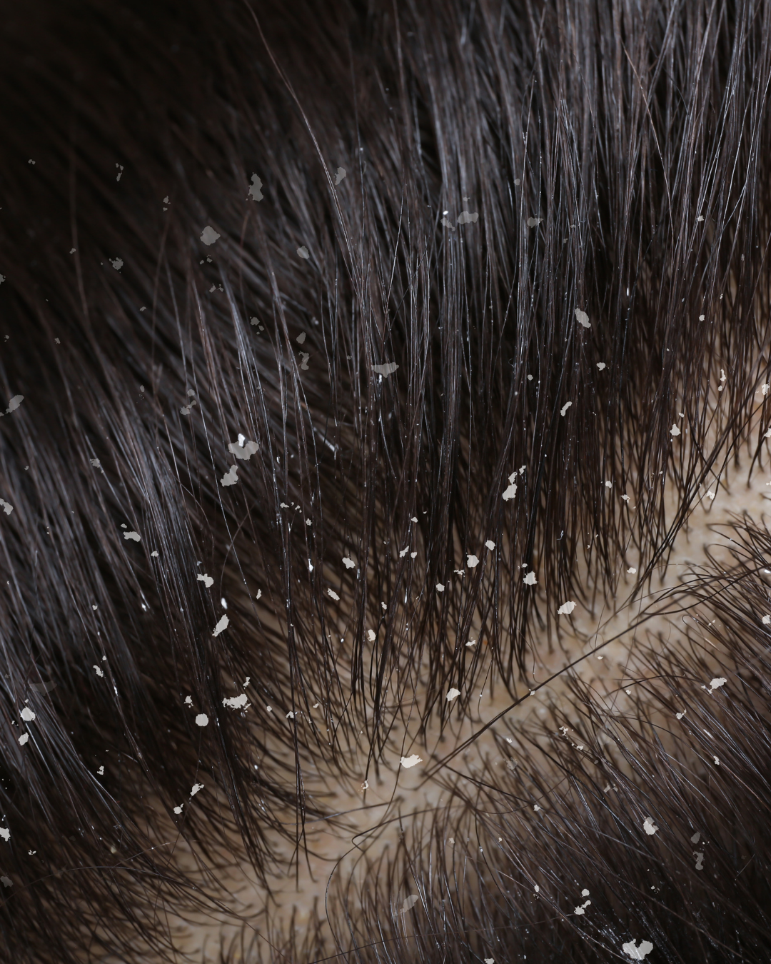 THALIA SCALP LAB Anti Dandruff Serum — görsel 6