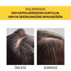Thalia Piroctone Olamine Kepeklenmeyi Önlemeye Yardımcı Saç Bakım Şampuanı 400ml - Thumbnail